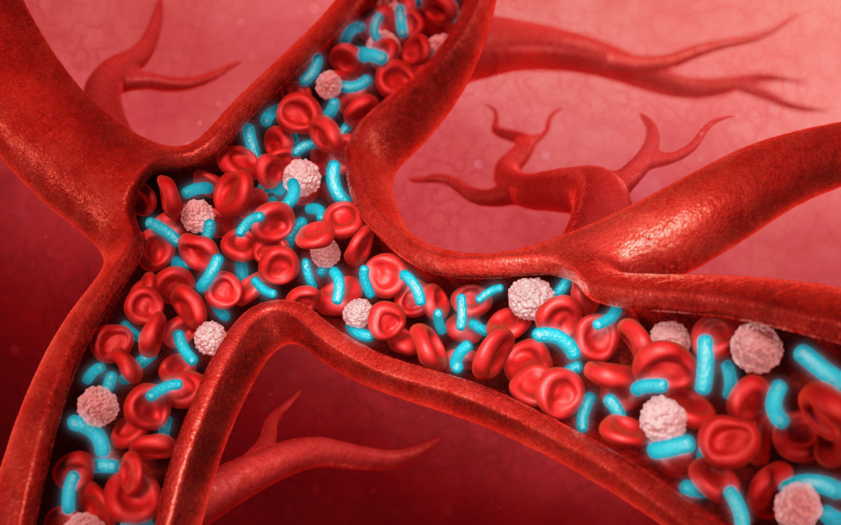 3d model sepsis in blood 